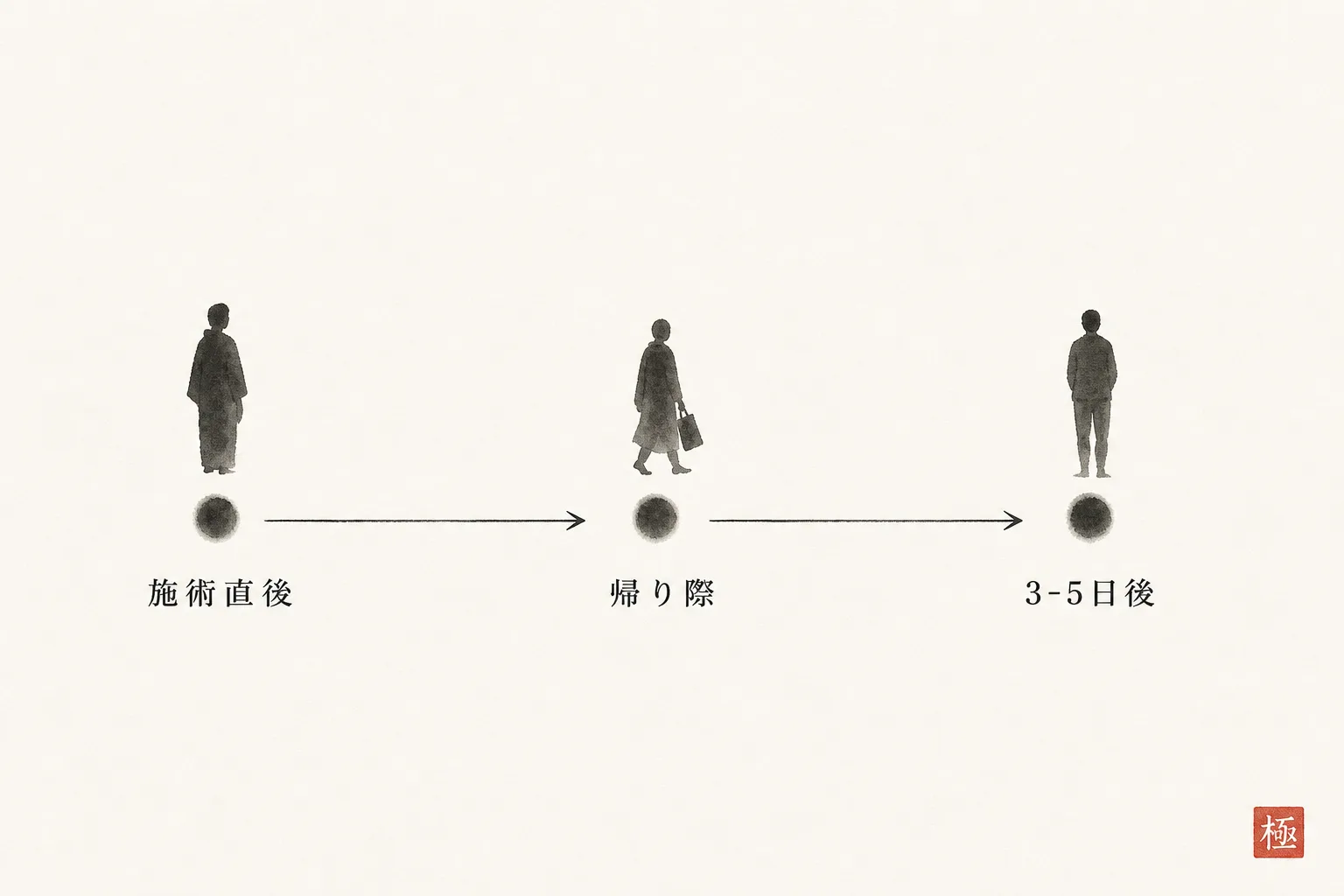 予約を追わずに戻ってきてもらう3つの接点を時系列で示す図